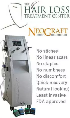 neograft hair replacement